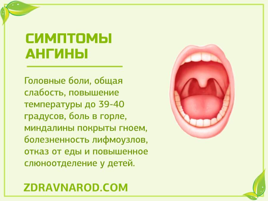 Герпетическая ангина (фото) и ее лечение у детей и взрослых