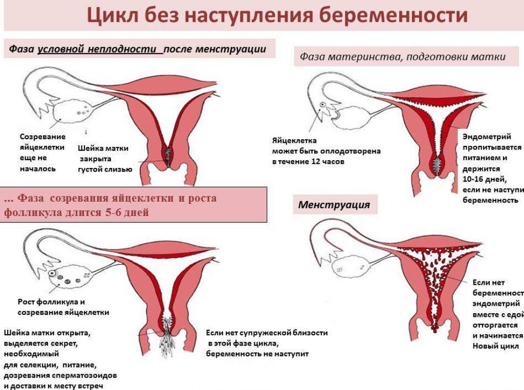 Очень сильные боли при менструации: причины и симптомы. что делать и как облегчить боли при месячных