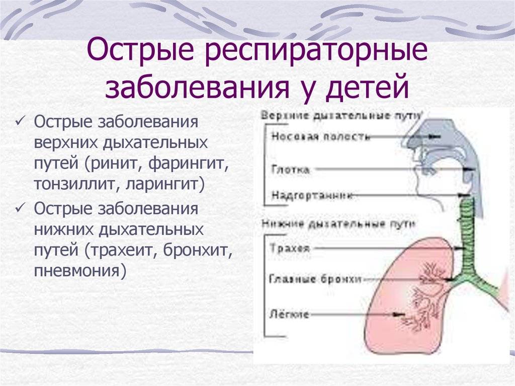 Острый и хронический трахеит - шарфом не обойтись