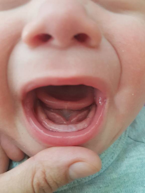 Режутся зубки: самые эффективные методы и советы как и чем можно помочь малышу