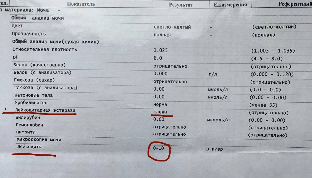 Лейкоцитарная эстераза в моче: что это значит у ребенка, причины, лечение