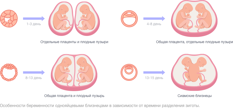 Беременность эко двойней