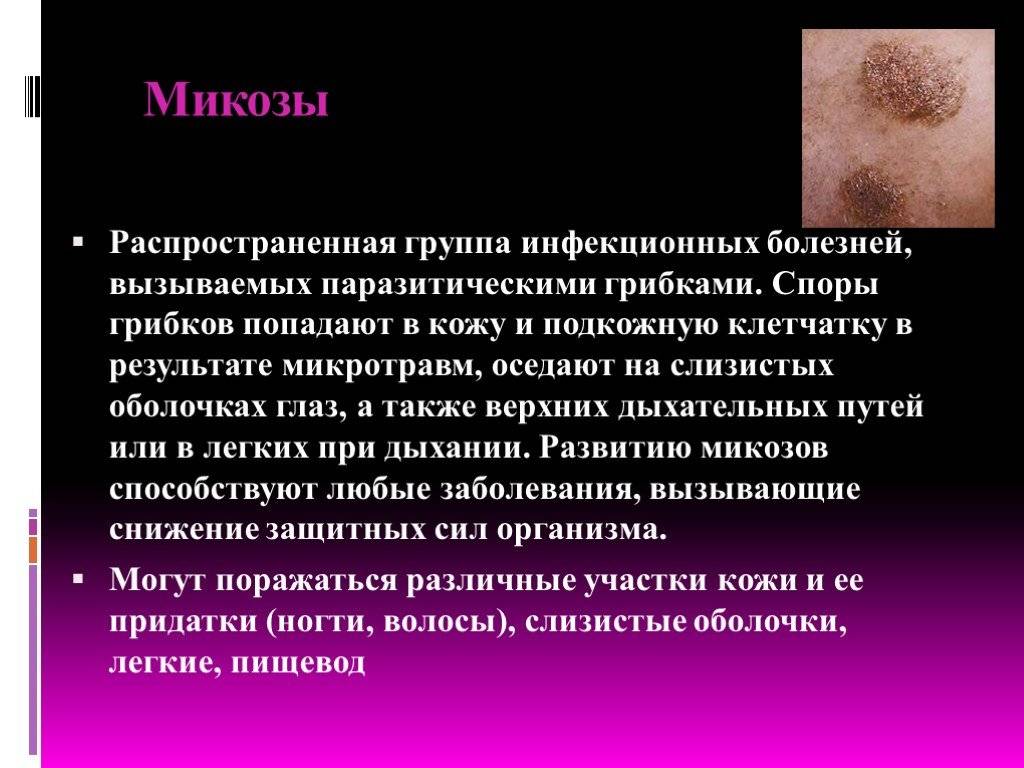 Грибковые заболевания кожи у детей: причины, симптомы и методы лечения