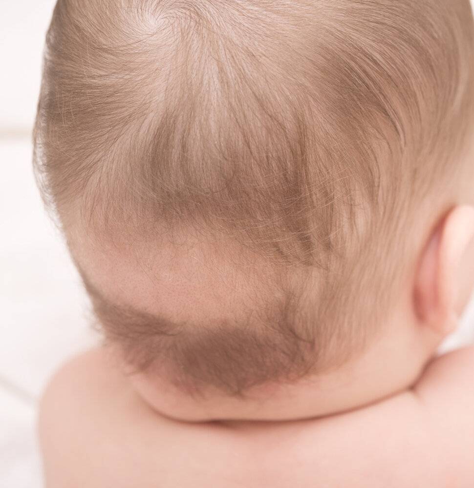 Почему у ребенка выпадают волосы: нормы, причины, методы лечения