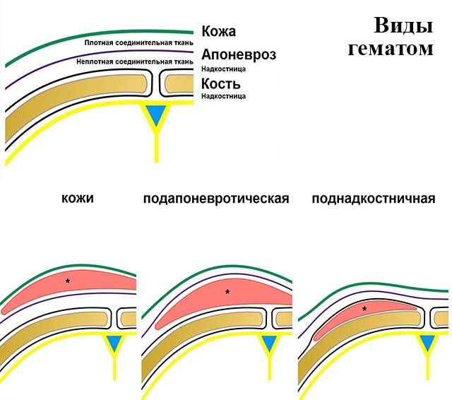 Ребенок упал, на голове шишка, что делать?