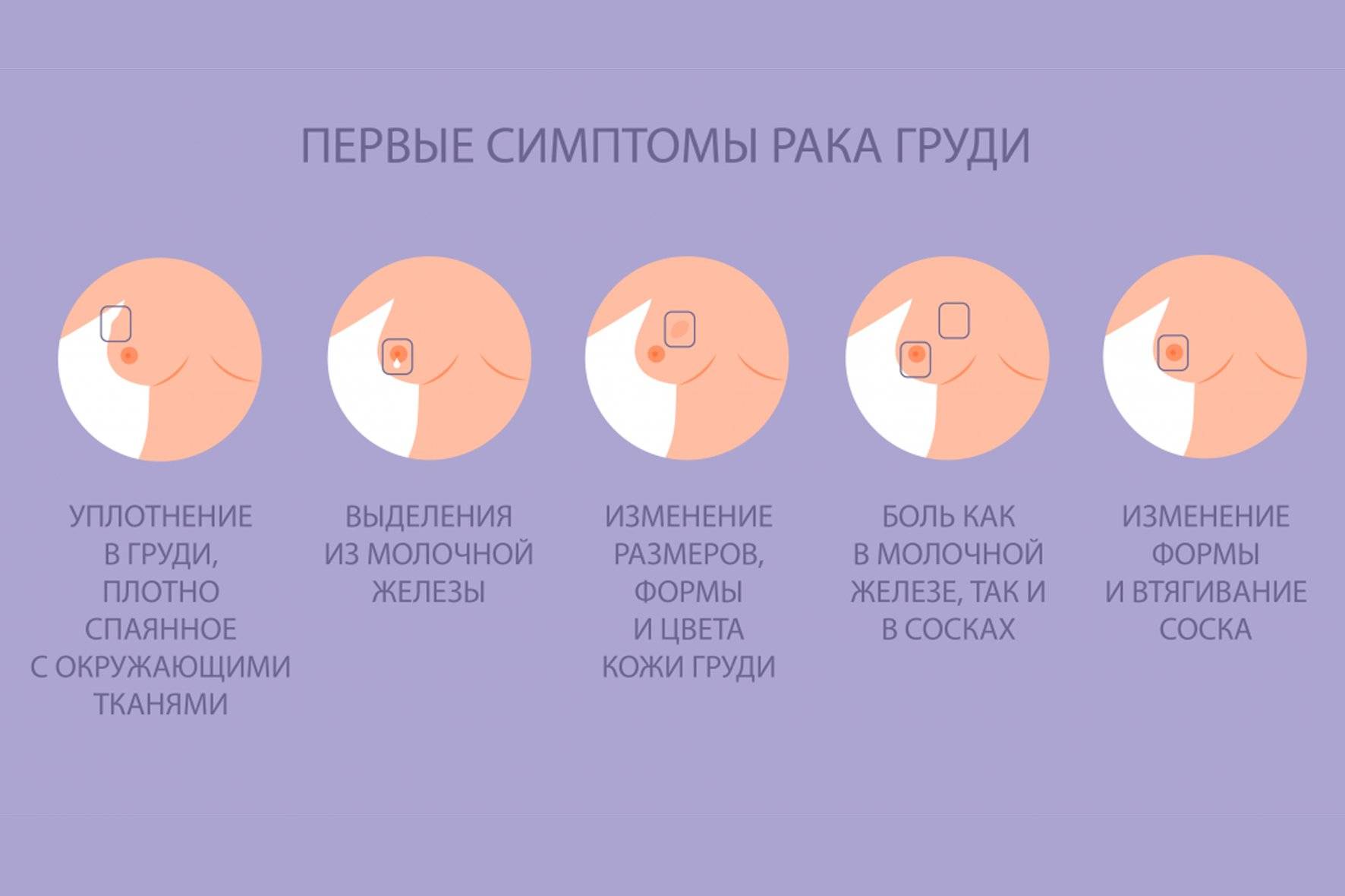 Соски при беременности: как выглядят на ранних и поздних сроках, почему темнеют?