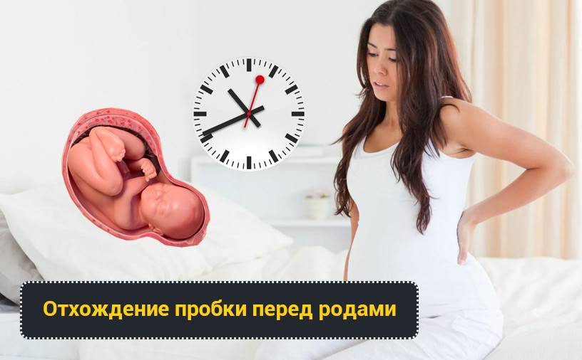 Слизистая пробка при беременности: как выглядит, как отходит, какого цвета слизистая пробка при беременности / mama66.ru