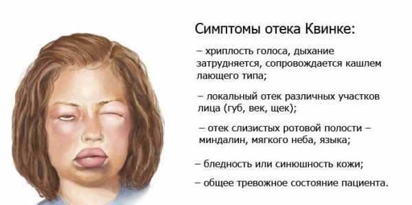 У ребенка опухла верхняя губа - возможные причины и что с этим делать | merilin-clinic.ru
