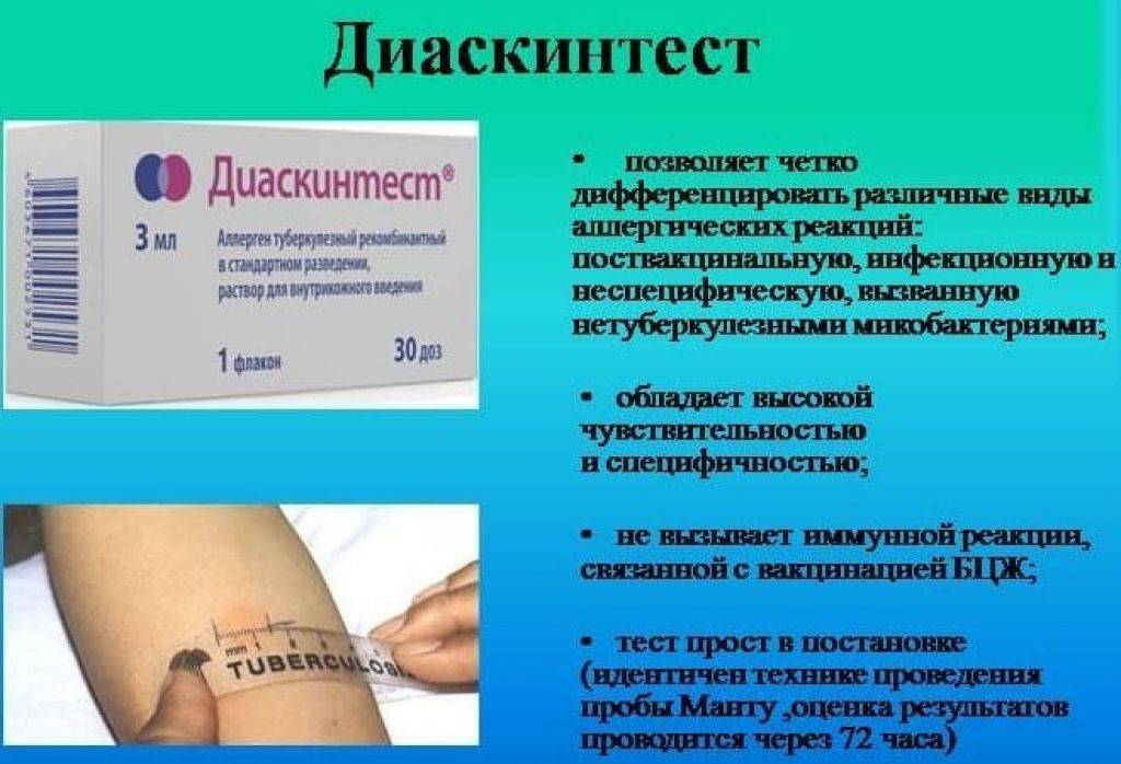 Методы диагностики туберкулеза - виды тестов на туберкулез, рентген