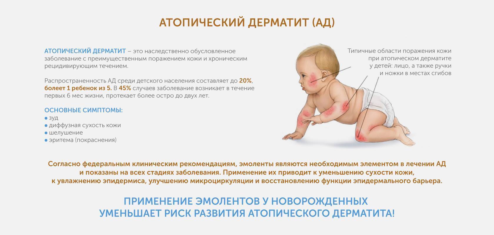 Аллергия на молоко у ребенка: симптомы, фото непереносимости белка у грудничка