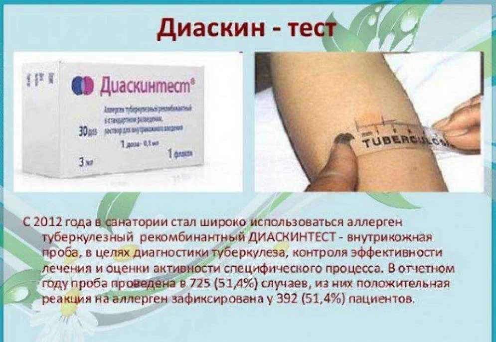 Диаскинтест: показания, противопоказания, вред, чем опасен, осложнения