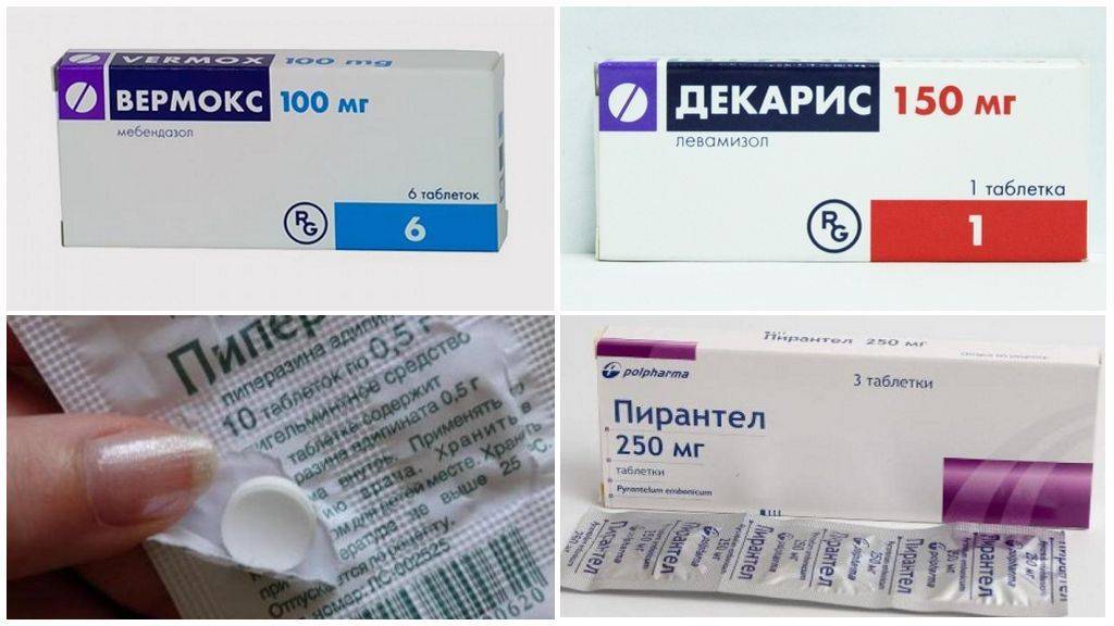 Лечение остриц у детей: препараты, лечение и профилактика энтеробиоза