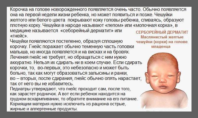 Ребенок чешет глаза и иногда нос: причины и способы решения проблемы