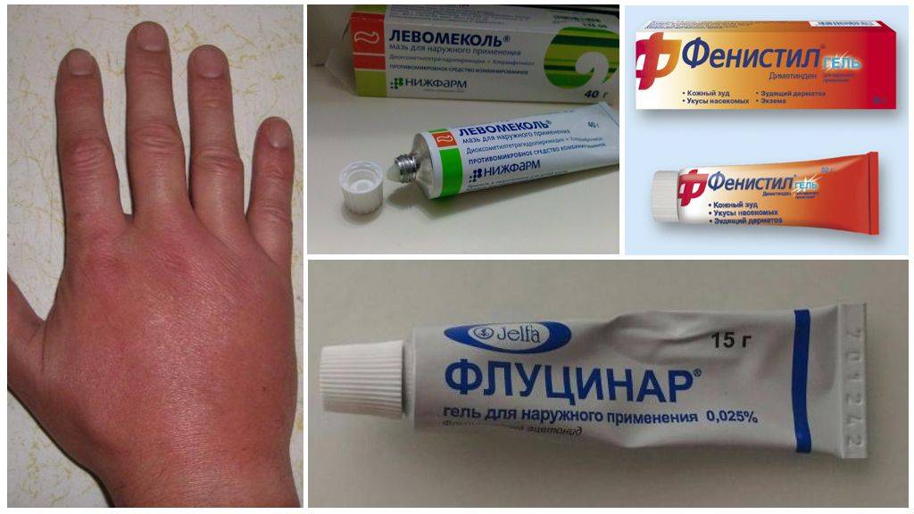 Укус слепня: чем опасен, симптомы, лечение, как снять отёк лекарствами и народными средствами