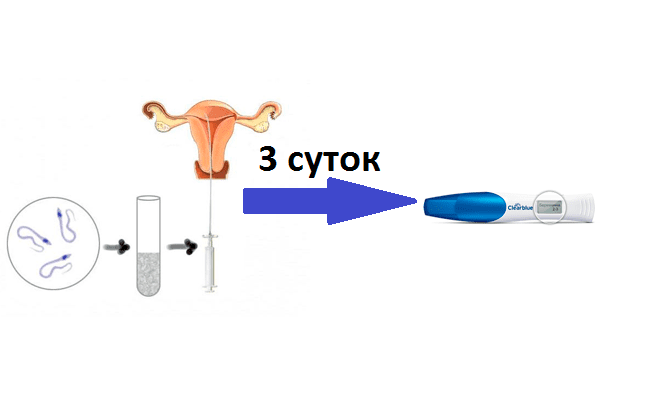 Криоперенос: на какой день цикла делают перенос замороженных эмбрионов