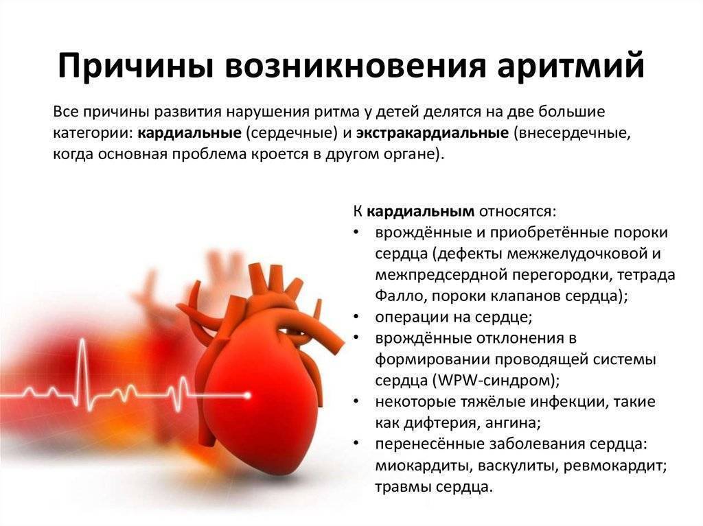Синусовая аритмия у детей и подростков: причины нарушения ритма сердца, норма на ЭКГ, профилактика