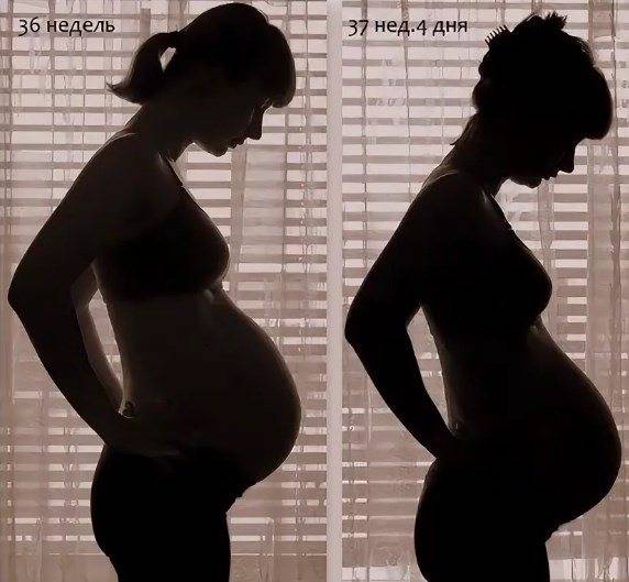 Мнение врачей о родах и беременности в 39 лет