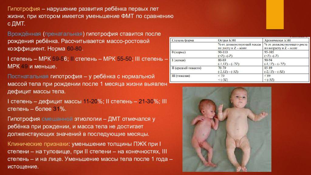 Новорожденные с недостаточной массой тела