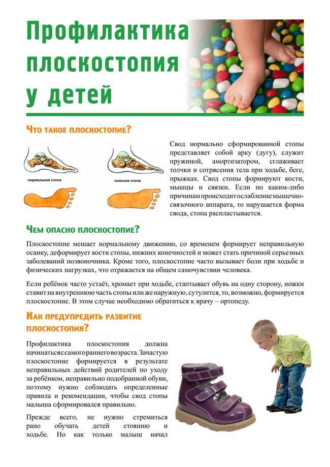 Плоскостопие у детей: причины, профилактика и методы лечения в домашних условиях