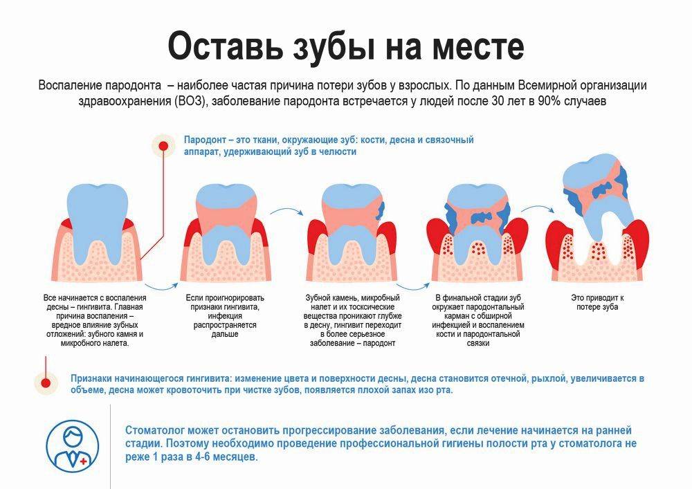 Гингивит у детей - популярные методики лечения