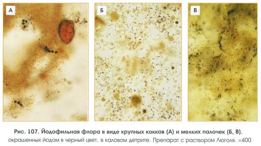 Йодофильная флора патологическая у ребенка, у взрослого