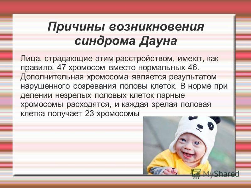 Болезнь дауна: признаки синдрома у плода при беременности, причины возникновения факторы риска
