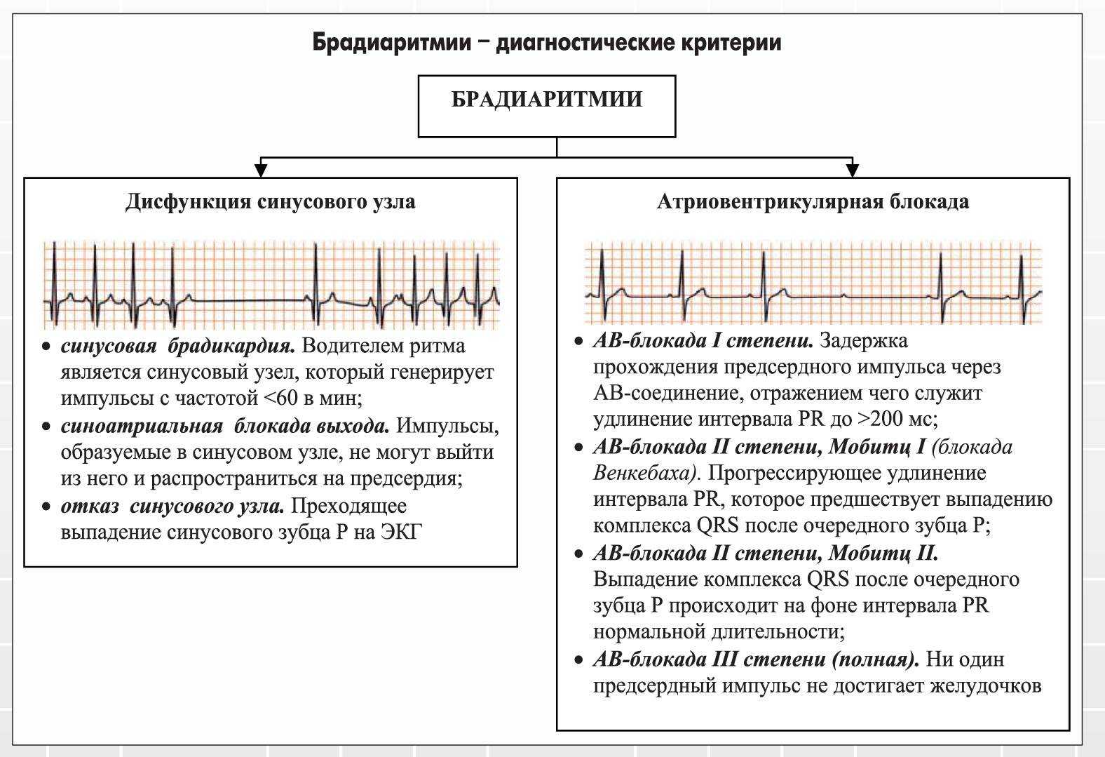 Брадикардия сердца у детей: можно ли заниматься спортом