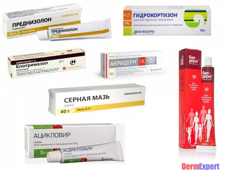 Лечение лишая народными средствами у детей | портал о народной медицине