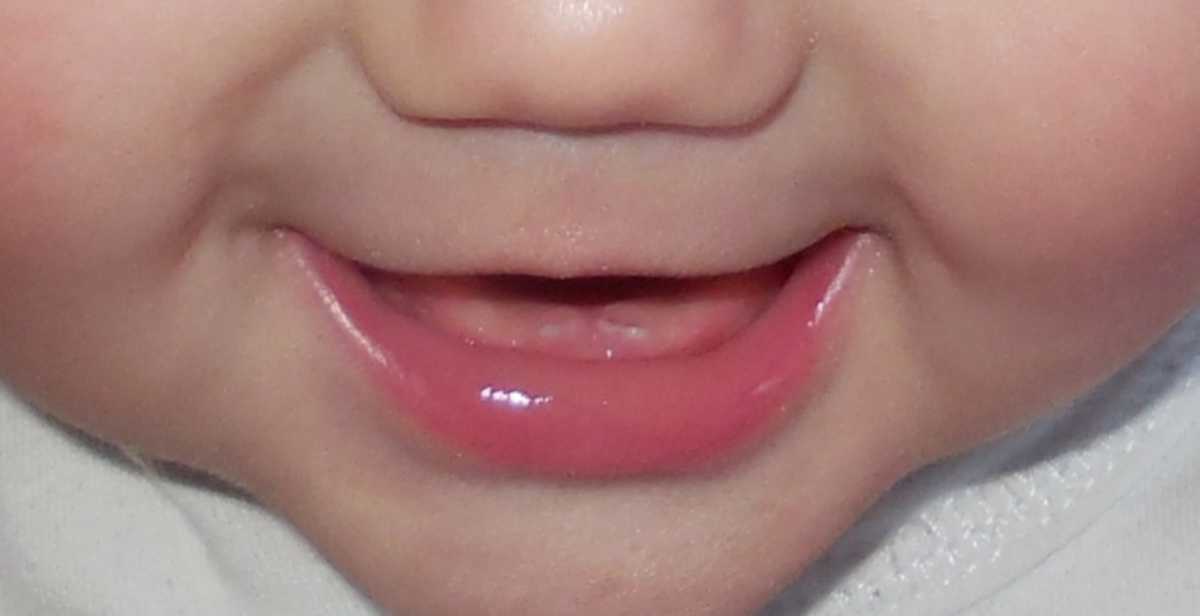Режутся зубы - как помочь ребенку и понять симптомы: состояние здоровья, когда лезут первые единицы