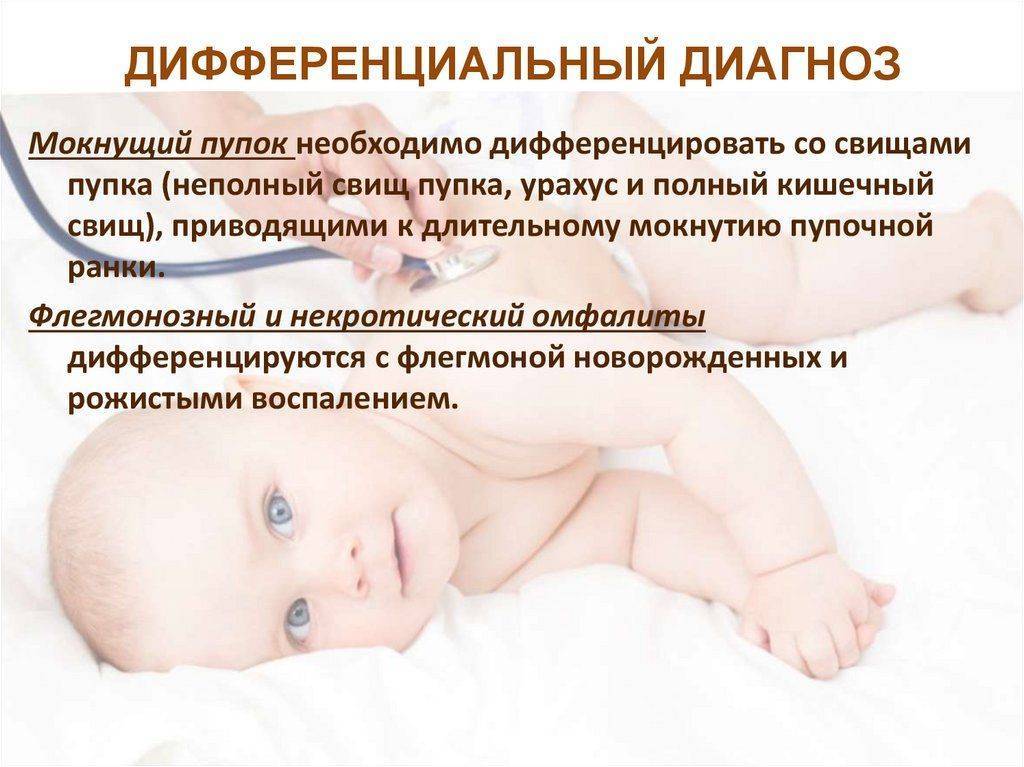 Омфалит пупка у новорожденных, взрослых и детей. лечение и профилактика омфалита