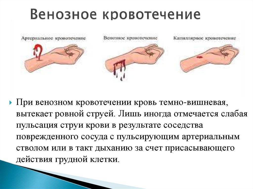 Гиперменструальный синдром: обильные месячные — это болезнь!