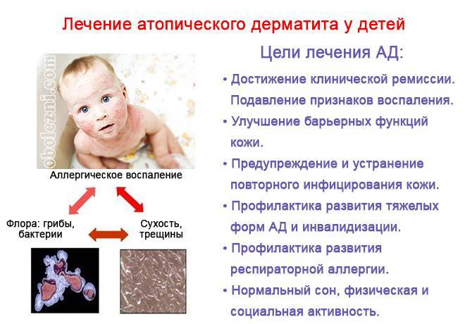 Как проявляется аллергия на смесь у новорожденного грудничка и что делать?