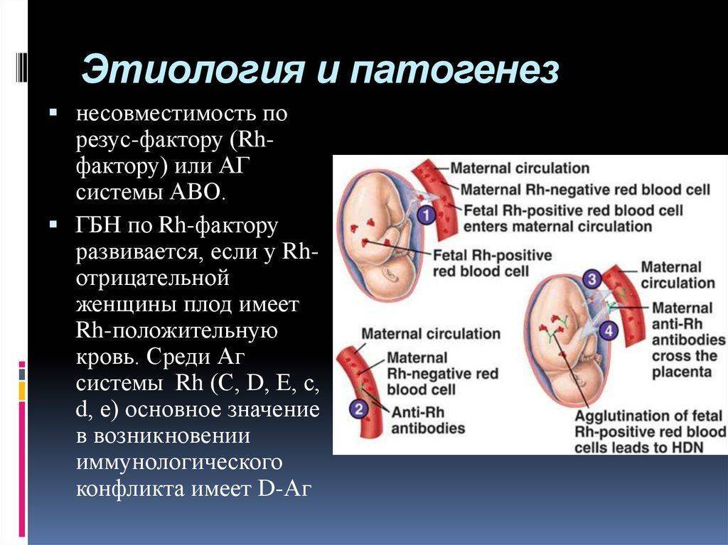 Лечение и последствия гемолитической болезни новорожденных по группе крови и резус-фактору