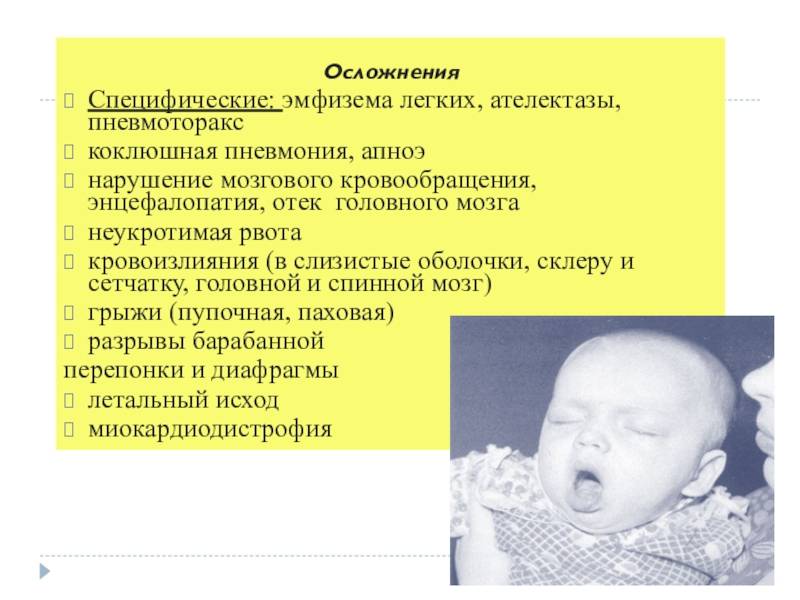 Отек мозга: причины, симптомы у взрослых, последствия и прогноз для жизни