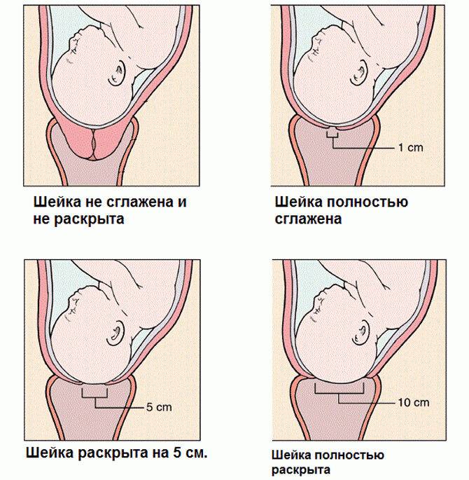 Матка через месяц после родов. Шейка матки при беременности 40 недель. Расположение шейки матки. Раскрытие матки при родах.