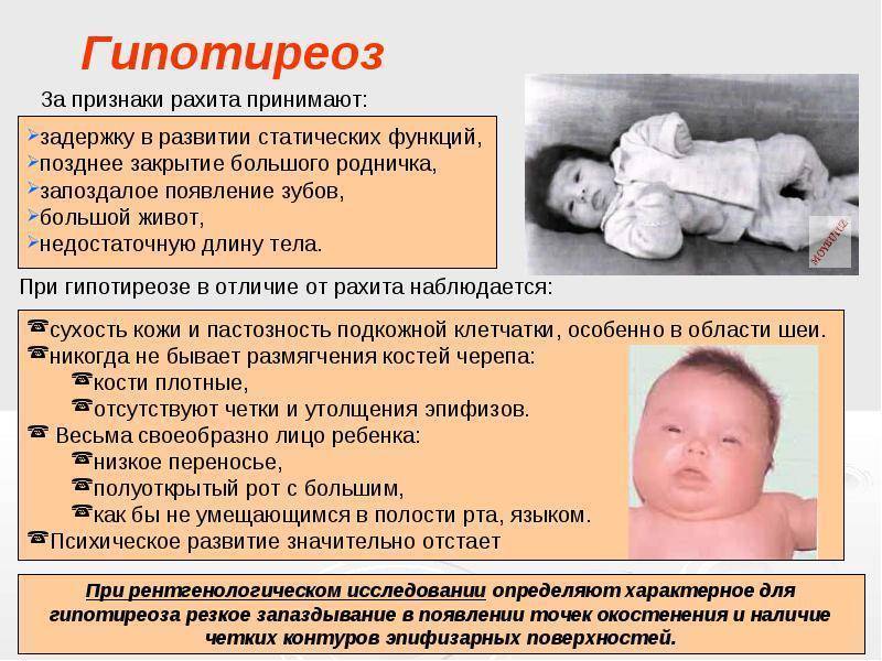 Стридор у новорождённых, грудничков, др детей и взрослых: причины, симптомы и пр