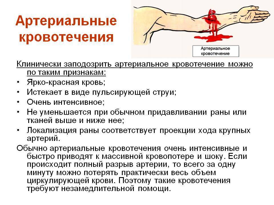 Обильные месячные: причины и методы остановки кровотечения