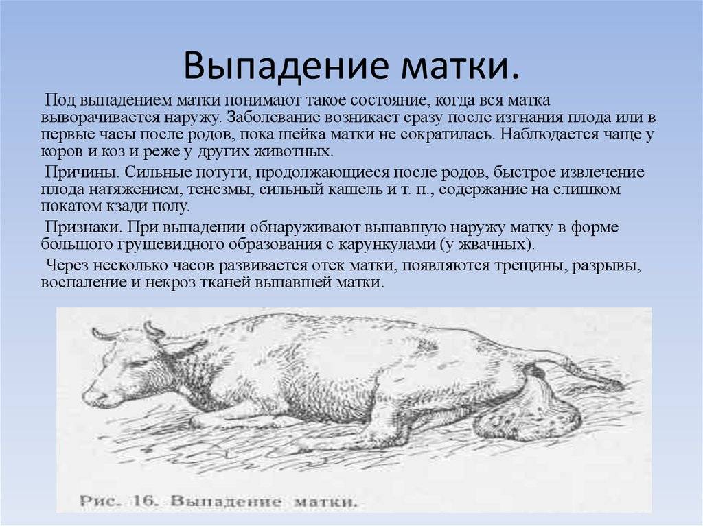 Пролапс матки