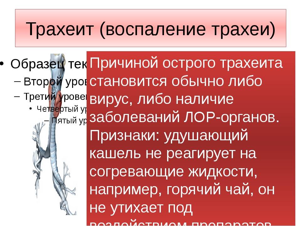 Острый трахеит: симптомы и лечение хронического трахеита, методы диагностики