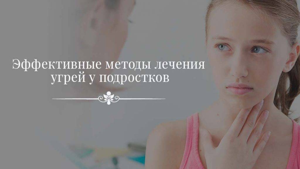 18 лучших средств от подростковых прыщей: самые эффективные варианты