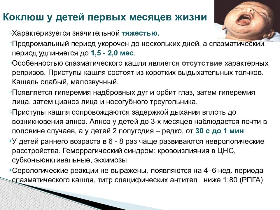 Что такое коклюш
