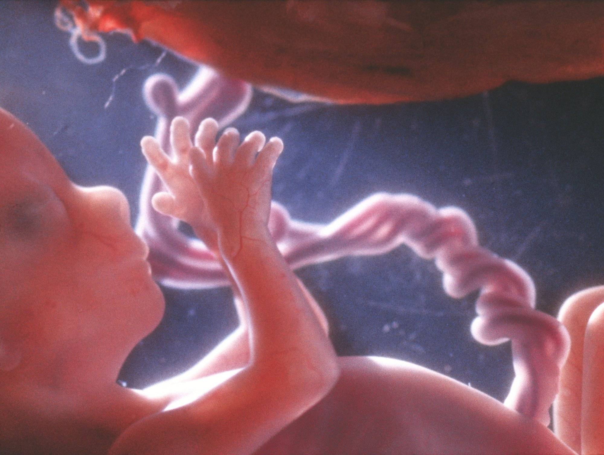 🤰 плачут ли дети в утробе матери: причины, признаки и важность - беременность(2023)