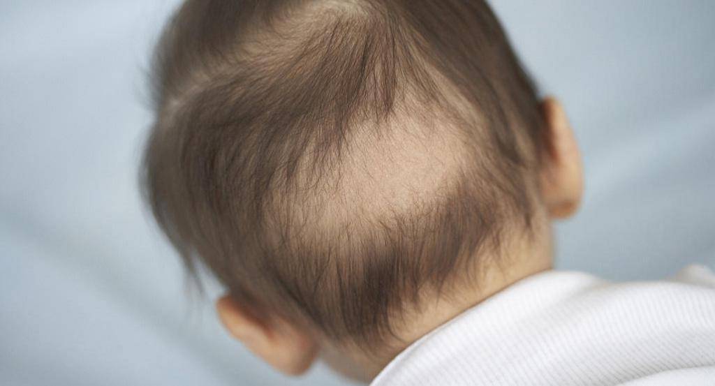 Почему у ребенка плохо растут волосы