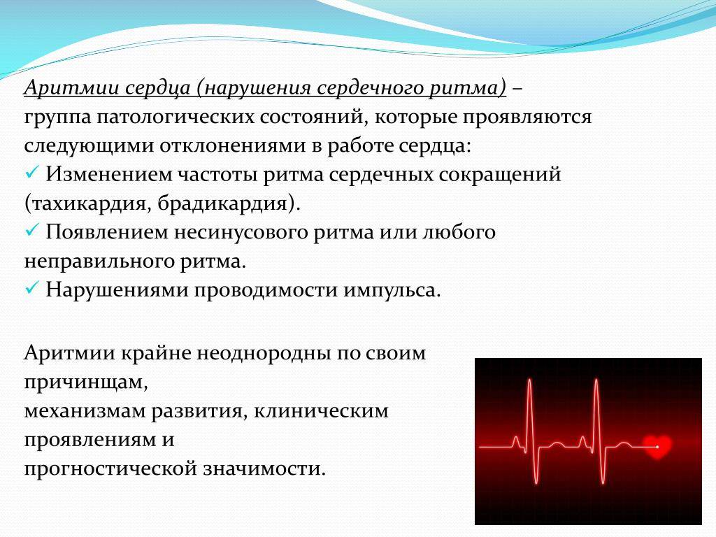 Аритмия у детей: причины патологии сердца, симптомы, лечение