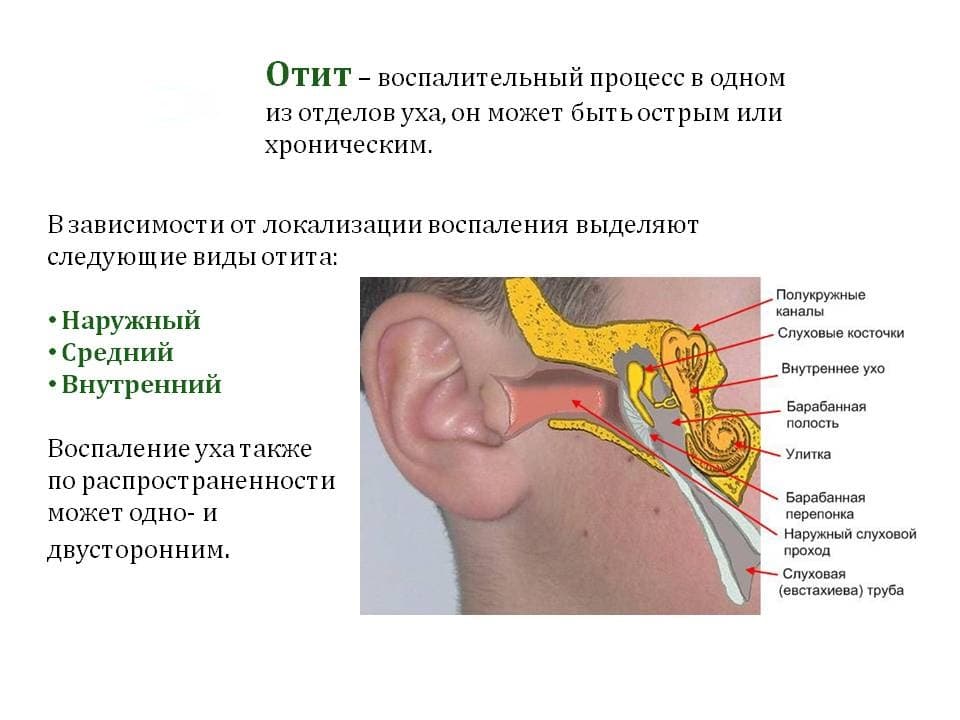 Катаральный отит у ребенка: симптомы и лечение