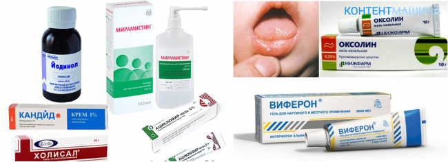Герпес во рту у ребенка как выглядит