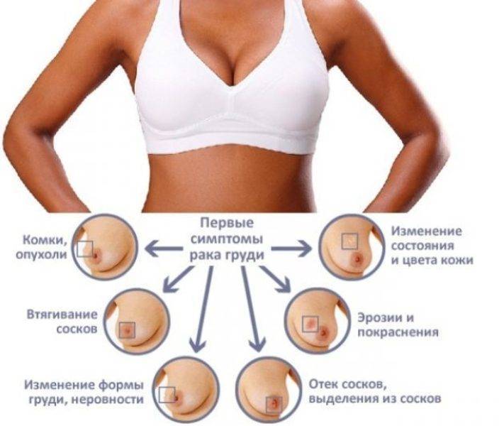 Потемнели ореолы сосков