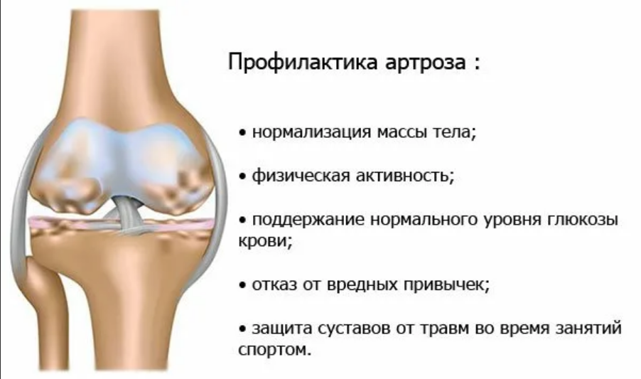 Артрит коленного сустава у детей: причины возникновения, симптомы и лечение