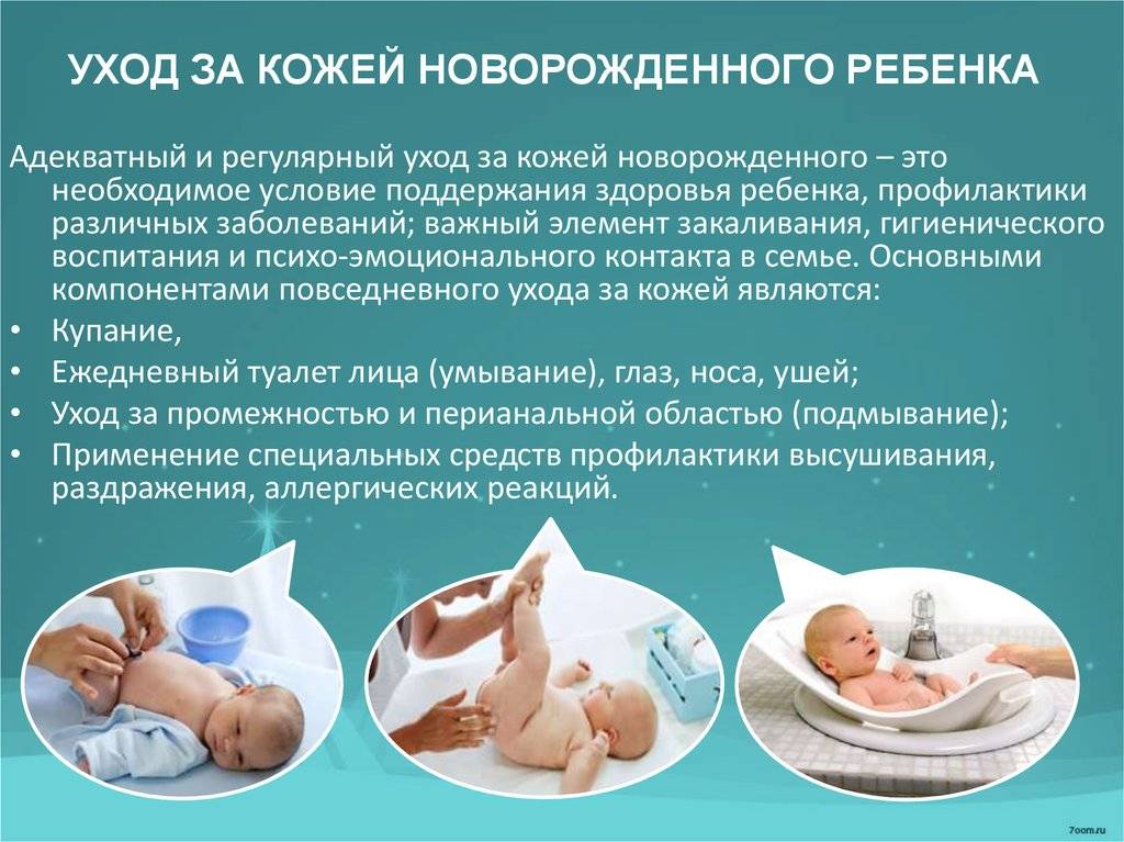 Гигиена новорожденных девочек, белый налет, особенности интимного ухода