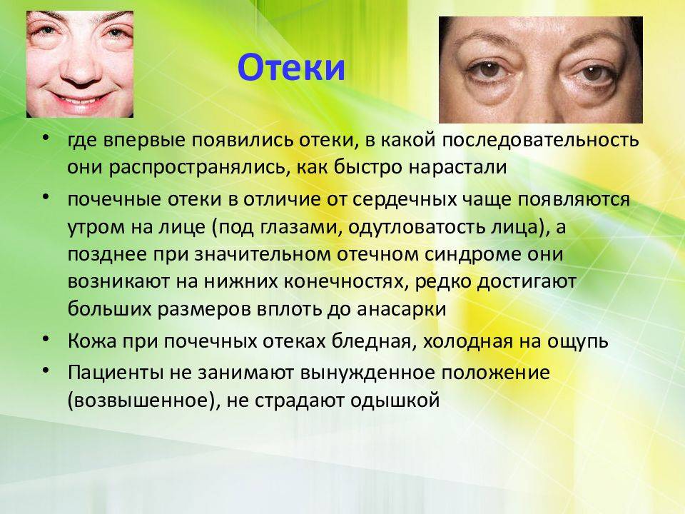 О чем говорят отеки и мешки под глазами у детей?